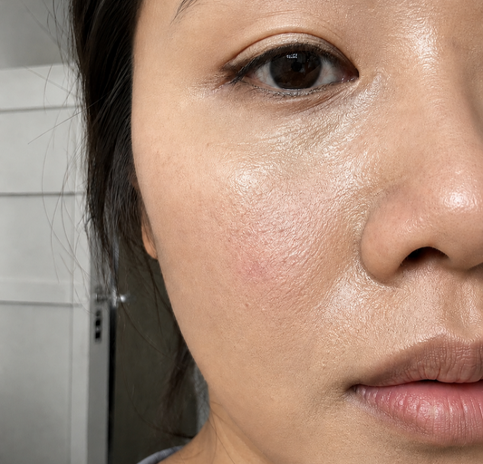 Why Is My T-Zone Shiny While My Cheek Makeup Looks Patchy by Lunchtime?