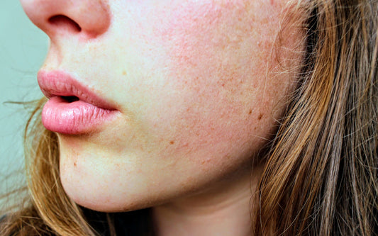 Why Does My Moisturizer Suddenly Sting My Face?